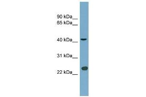 ART3 antibody used at 0. (ART3 抗体  (Middle Region))