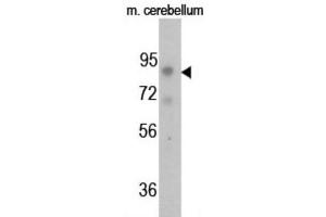 Western Blotting (WB) image for anti-FGFR (pTyr766) antibody (ABIN3001757) (FGFR (pTyr766) 抗体)