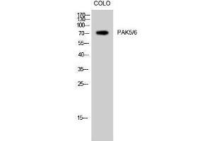 Western Blotting (WB) image for anti-PAK5/6 (Ser1197) antibody (ABIN3176756) (PAK5/6 (Ser1197) 抗体)