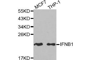 Western blot analysis of extracts of MCF7 and THP-1 cell lines, using IFNB1 antibody. (IFNB1 抗体)