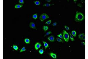 Immunofluorescent analysis of PC-3 cells using ABIN7145339 at dilution of 1:100 and Alexa Fluor 488-congugated AffiniPure Goat Anti-Rabbit IgG(H+L) (ATG14 抗体  (AA 1-492))