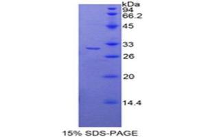 SDS-PAGE (SDS) image for Histone Deacetylase 6 (HDAC6) (AA 560-811) protein (His tag) (ABIN1879672) (HDAC6 Protein (AA 560-811) (His tag))