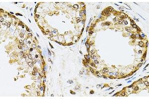 Immunohistochemistry of paraffin-embedded Human prostate using POP4 Polyclonal Antibody at dilution of 1:100 (40x lens). (RPP29 抗体)