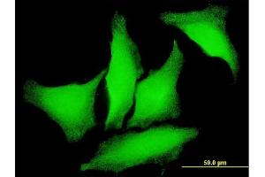 Immunofluorescence of monoclonal antibody to PKD2 on HeLa cell. (PKD2 抗体  (AA 261-360))