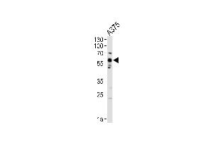 Western Blotting (WB) image for anti-Proto-oncogene tyrosine-protein kinase Src (Src) (AA 397-424) antibody (ABIN652537)