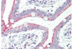 Immunohistochemistry (IHC) image for anti-Solute Carrier Family 33 Member 1 (SLC33A1) (Middle Region) antibody (ABIN2781611)