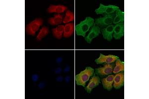 ABIN6259828 and ABIN6278001 staining Hela cells by IF/ICC. (AGR2 抗体  (N-Term))
