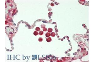 IHC-P analysis of Human Lung Tissue, with HE staining. (CHI3L1 抗体  (AA 112-377))