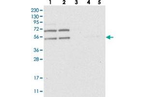 Western blot analysis of Lane 1: RT-4, Lane 2: U-251 MG, Lane 3: Human Plasma, Lane 4: Liver, Lane 5: Tonsil with C2orf30 polyclonal antibody . (C2orf30 抗体)