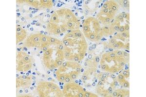 Immunohistochemistry of paraffin-embedded Mouse kidney using C1GALT1 Polyclonal Antibody at dilution of 1:100 (40x lens). (C1GALT1 抗体)