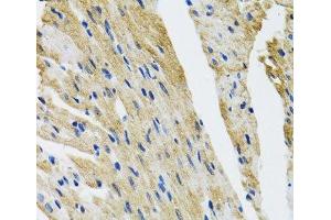 Immunohistochemistry (Paraffin-embedded Sections) (IHC (p)) image for anti-Coatomer Protein Complex, Subunit beta 2 (COPB2) antibody (ABIN7011528)