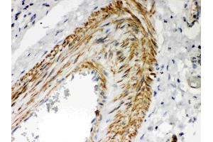 anti-Protein Kinase C, iota (PRKCI) (AA 21-214) antibody