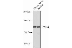 Western blot analysis of extracts of various cell lines, using  Rabbit mAb (ABIN7265427) at 1:1000 dilution. (ACSS2 抗体)