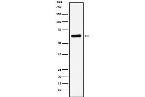 Western blot analysis of EHD1 expression in HepG2 cell lysate.