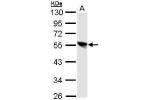 WB Image Sample (30 ug of whole cell lysate) A: 293T 10% SDS PAGE antibody diluted at 1:1000 (DP1 抗体)