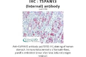 Image no. 2 for anti-Tetraspanin 13 (TSPAN13) (Internal Region) antibody (ABIN1740425) (TSPAN13 抗体  (Internal Region))