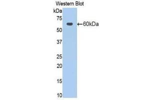 Western Blotting (WB) image for anti-Activated Leukocyte Cell Adhesion Molecule (ALCAM) (AA 28-527) antibody (ABIN1077751) (CD166 抗体  (AA 28-527))