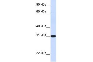 PBLD antibody used at 1 ug/ml to detect target protein.