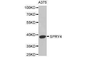 Western Blotting (WB) image for anti-Sprouty RTK Signaling Antagonist 4 (SPRY4) antibody (ABIN1980279) (SPRY4 抗体)