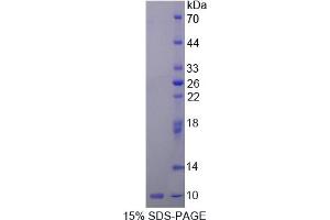 SDS-PAGE analysis of Rat Insulin Like Growth Factor 2 (IGF2) Protein. (IGF2 蛋白)