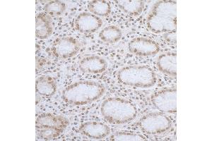 Immunohistochemistry (IHC) image for anti-ElaC Homolog 2 (ELAC2) (AA 150-200) antibody (ABIN7455053) (ELAC2 抗体  (AA 150-200))