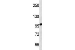 STIM2 antibody western blot analysis in uterus tumor lysate. (Stim2 抗体  (AA 98-127))