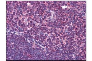 Immunohistochemistry (Paraffin-embedded Sections) (IHC (p)) image for anti-Hydrogen Voltage-Gated Channel 1 (HVCN1) (C-Term) antibody (ABIN784098)