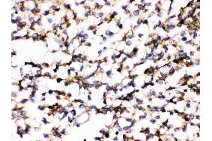 Anti- KCNIP2 Picoband antibody,IHC(P) IHC(P): Human Glioma Tissue (KCNIP2 抗体  (N-Term))