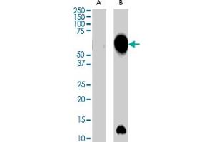 AIRE polyclonal antibody  (0. (AIRE 抗体)