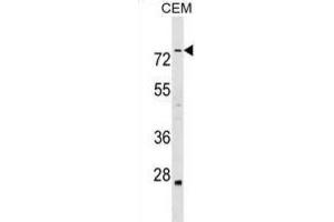 Western Blotting (WB) image for anti-Actin Binding LIM Protein Family, Member 3 (ABLIM3) antibody (ABIN2999456) (ABLIM3 抗体)