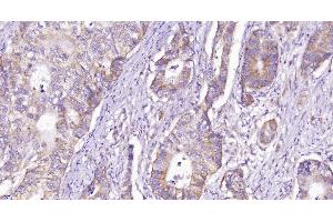 Immunohistochemistry (Paraffin-embedded Sections) (IHC (p)) image for anti-CD28 (CD28) (AA 1-120) antibody (ABIN674604)