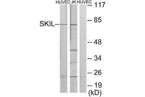 Western Blotting (WB) image for anti-SKI-Like Oncogene (SKIL) (C-Term) antibody (ABIN1849158) (SKIL 抗体  (C-Term))