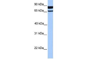 WB Suggested Anti-PDE1C Antibody Titration: 0. (PDE1C 抗体  (N-Term))