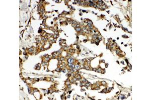 Immunohistochemistry (IHC) image for anti-One Cut Homeobox 1 (ONECUT1) (AA 187-203), (N-Term) antibody (ABIN3044467)