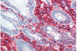 Immunohistochemistry (Paraffin-embedded Sections) (IHC (p)) image for anti-CD44 (CD44) antibody (ABIN396970)