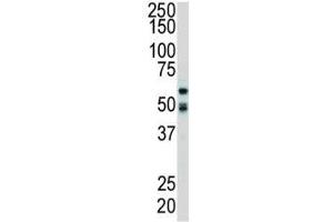 Western blot analysis of RIPK2 antibody and mouse cerebellum tissue lysate. (RIPK2 抗体  (AA 458-488))