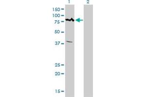 Western Blotting (WB) image for anti-Calcium Responsive Transcription Factor (CARF) (AA 621-719) antibody (ABIN599306) (Calcium Responsive Transcription Factor (CARF) (AA 621-719) 抗体)