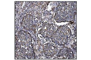 IHC analysis of CLPP using anti-CLPP antibody (ABIN5693176).