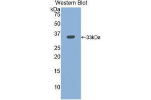 Western Blotting (WB) image for anti-Integrin beta 3 (ITGB3) (AA 134-376) antibody (ABIN1859506) (Integrin beta 3 抗体  (AA 134-376))