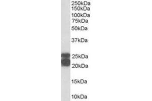 Image no. 2 for anti-Caveolin 1, Caveolae Protein, 22kDa (CAV1) (Internal Region) antibody (ABIN374578) (Caveolin-1 抗体  (Internal Region))