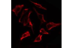 ABIN6274867 staining Hela cells by IF/ICC. (ARSF 抗体  (Internal Region))