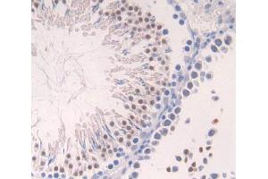 Used in DAB staining on fromalin fixed paraffin- embedded Kidney tissue (Aurora Kinase C 抗体  (AA 20-277))