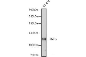 Western blot analysis of extracts of BT-474 cells using TMC5 Polyclonal Antibody at dilution of 1:1000. (Tmc5 抗体)