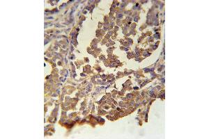 Immunohistochemistry (IHC) image for anti-Melanocortin 5 Receptor (MC5R) (AA 261-288), (C-Term) antibody (ABIN5531639)