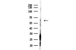 Western blot analysis of lysates from HUVEC cells(starvation,24h treatment), using Phospho-Smad5 (Ser463/Ser465) Antibody at 1/1000 dilution.