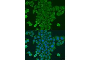 Immunofluorescence analysis of U2OS cells using DPM1 antibody (ABIN2736653) at dilution of 1:100. (DPM1 抗体)