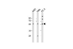 Western Blot at 1:2000 dilution Lane 1: A431 whole cell lysate Lane 2: Hela whole cell lysate Lane 3: PC-3 whole cell lysate Lysates/proteins at 20 ug per lane. (CCT8L2 抗体  (AA 511-542))