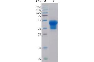 Human IL2RA Protein, His Tag on SDS-PAGE under reducing condition. (CD25 Protein (His tag))