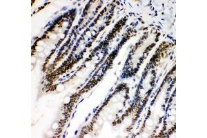 Anti- HIF 1 alpha Picoband antibody,IHC(P) IHC(P): Rat Intestine Tissue