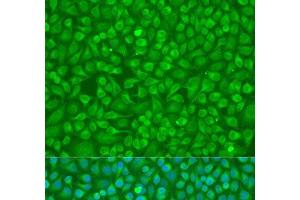 Immunofluorescence analysis of U2OS cells using MMP8 Polyclonal Antibody at dilution of 1:100. (MMP8 抗体)